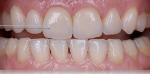 Smile Gallery. Dentist in Beverly Hills, CA. Dr. Hessam Nowzari, D.D.S., Ph.D., Dr. Eric Cho, D.D.S. Hessam Nowzari DDS, PHD