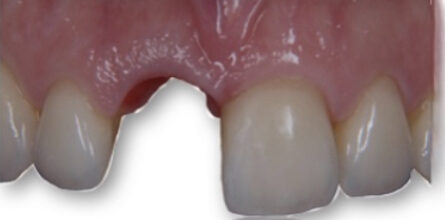 Smile Gallery. Dentist in Beverly Hills, CA. Dr. Hessam Nowzari, D.D.S., Ph.D., Dr. Eric Cho, D.D.S. Hessam Nowzari DDS, PHD