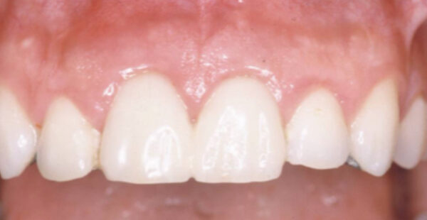 Smile Gallery. Dentist in Beverly Hills, CA. Dr. Hessam Nowzari, D.D.S., Ph.D., Dr. Eric Cho, D.D.S. Hessam Nowzari DDS, PHD